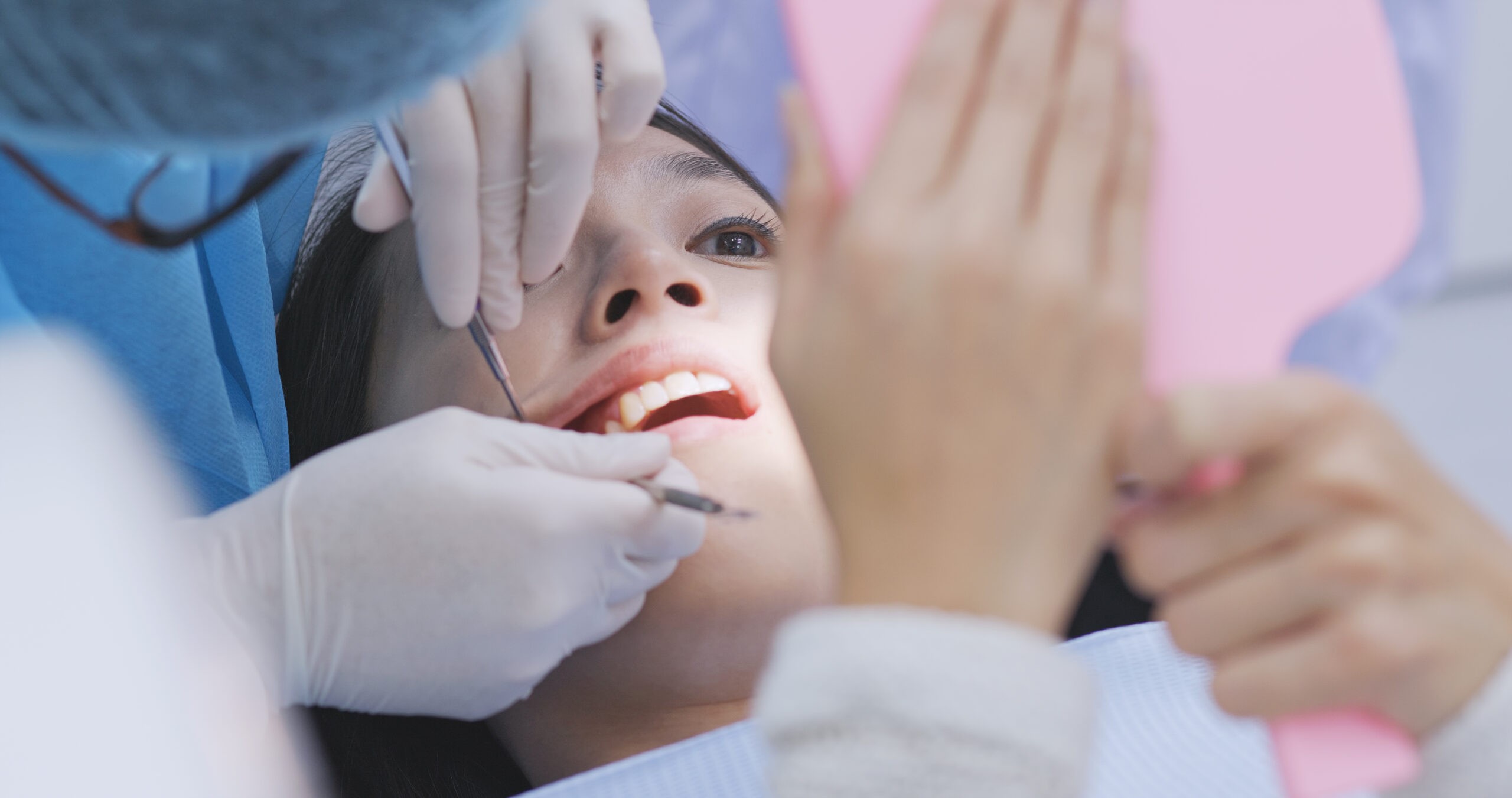 Dental Implants