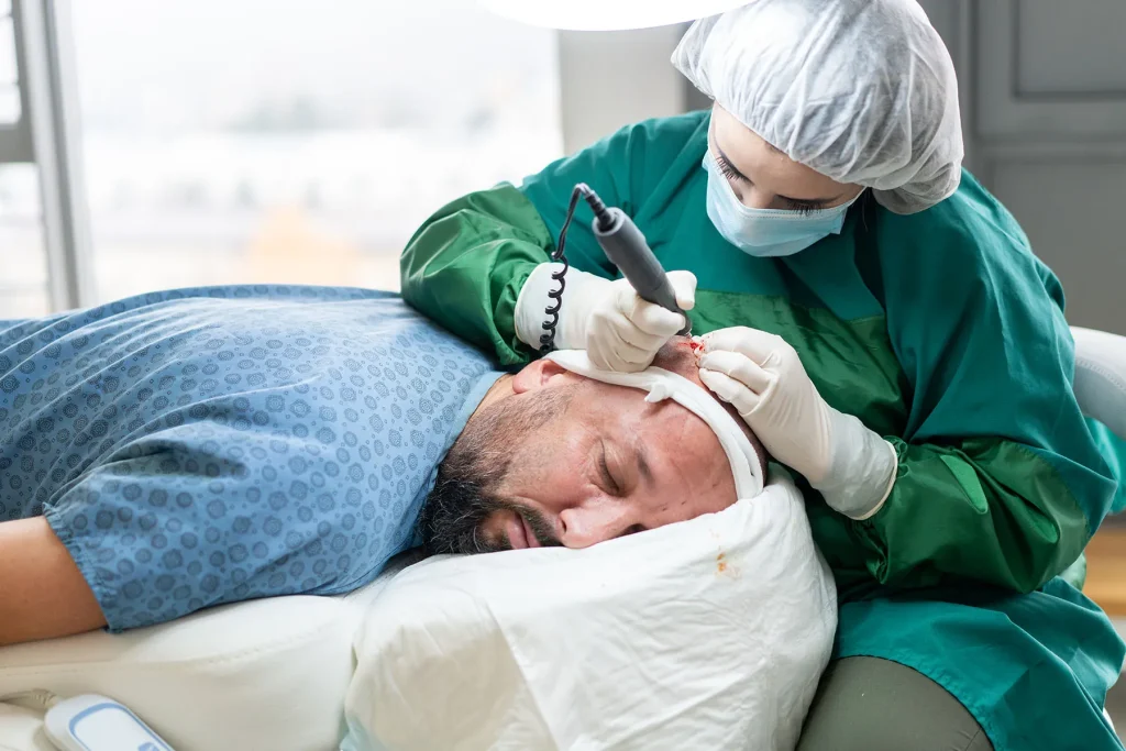 Hair transplant uk
